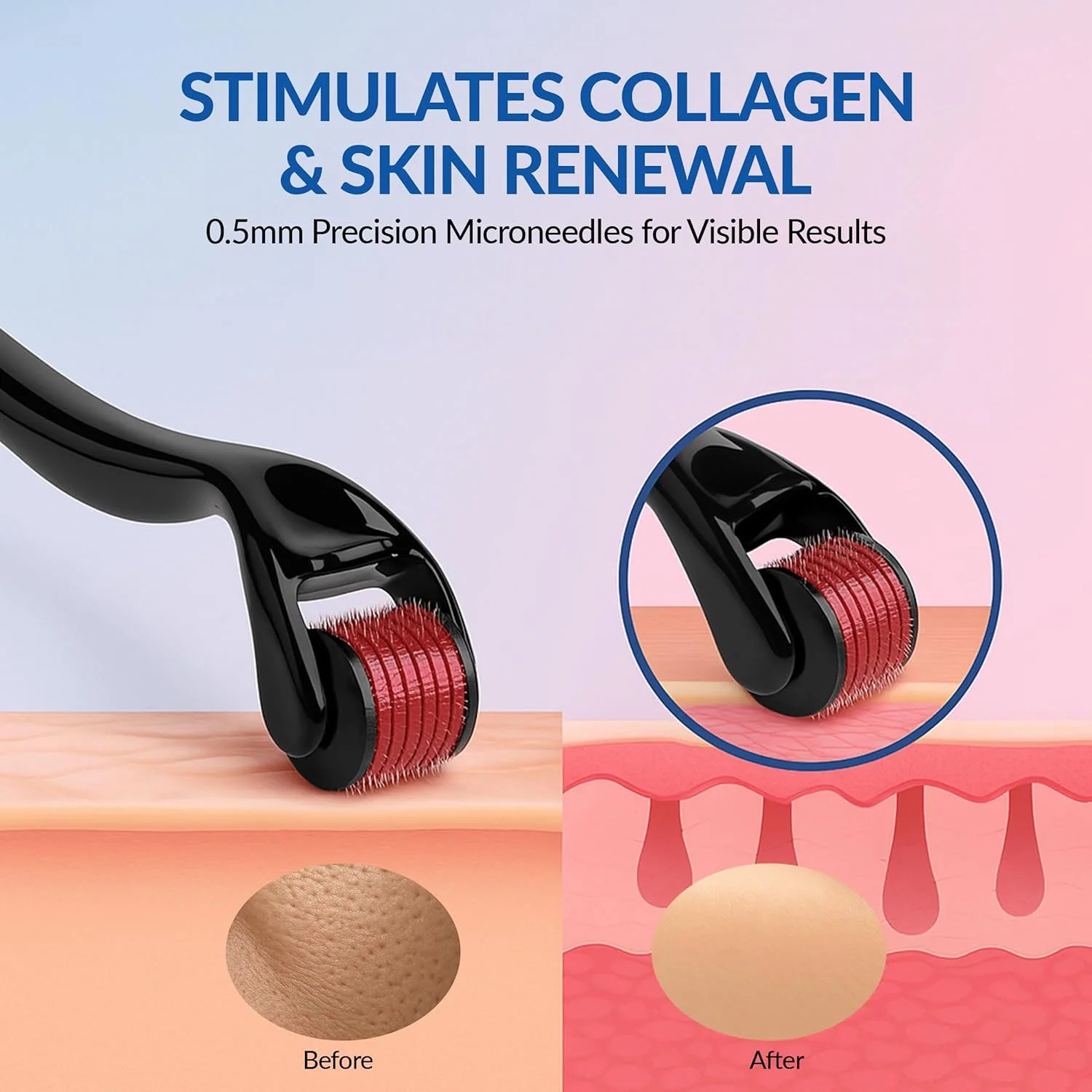 Microneedle Derma Roller for Face (1 Pc, 0.5mm) - Image 3