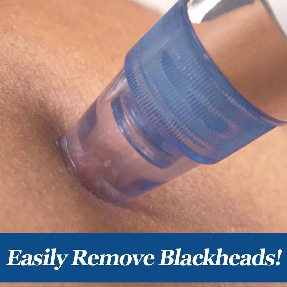 4-in-1 Blackhead Extractor – Vacuum Suction Acne Remover & Pore Cleaner - Image 5