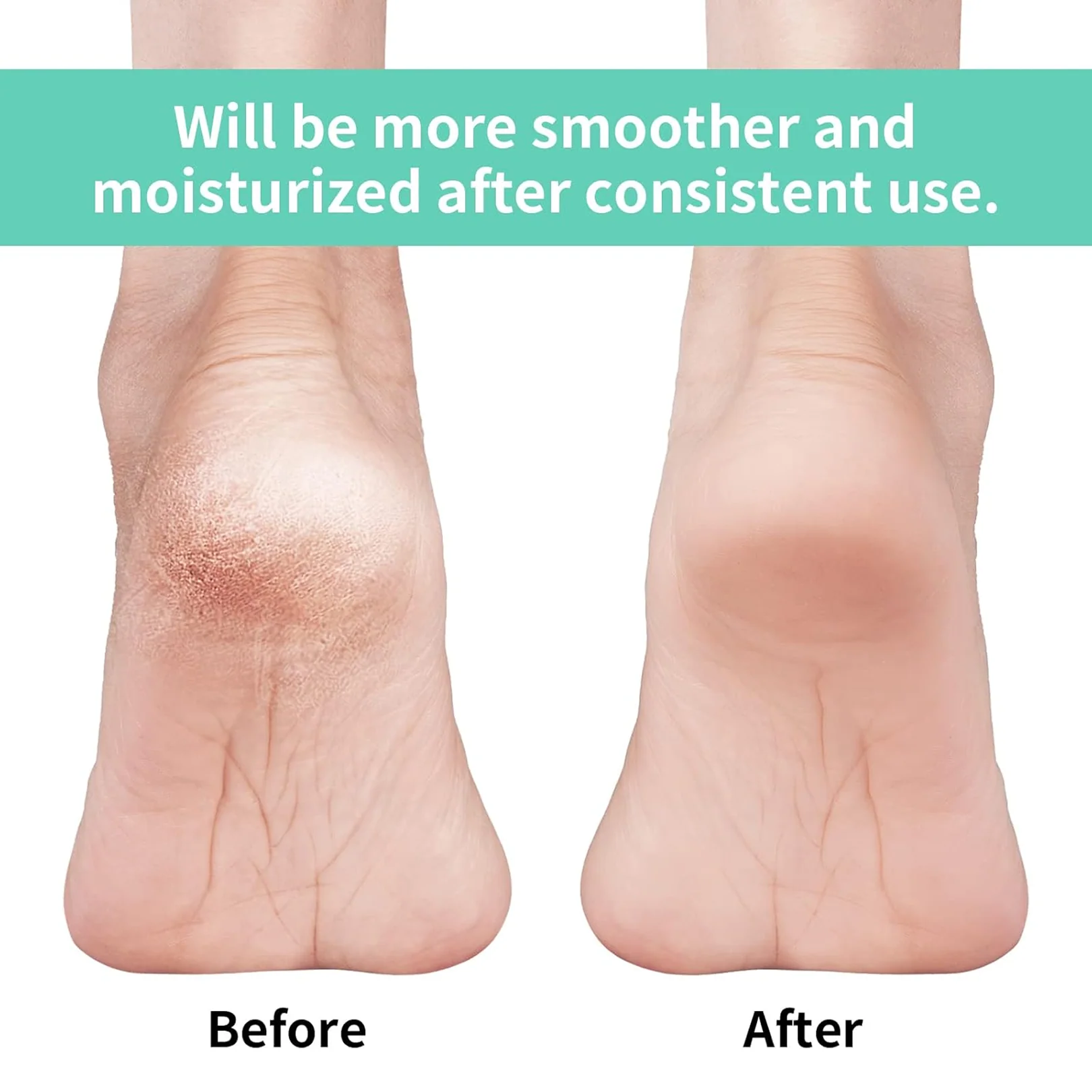 Anti Crack Silicon Gel Heel Moisturizing Socks for Foot Care Men Women (Loose Pack) - Image 3