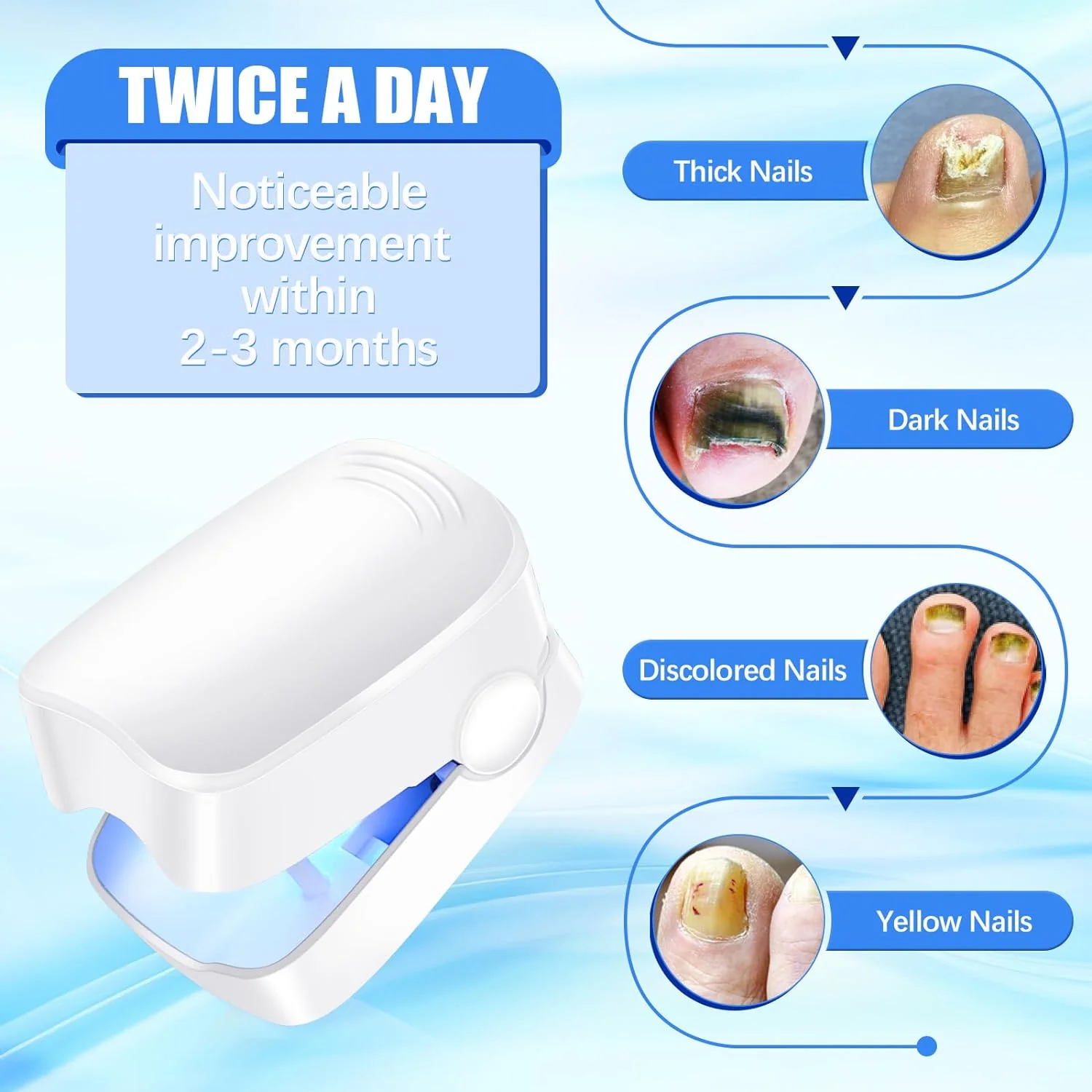 Rechargeable Nail Fungus Laser – Anti-Fungal Device Toenails, Hands & Feet (Home Use) - Image 8