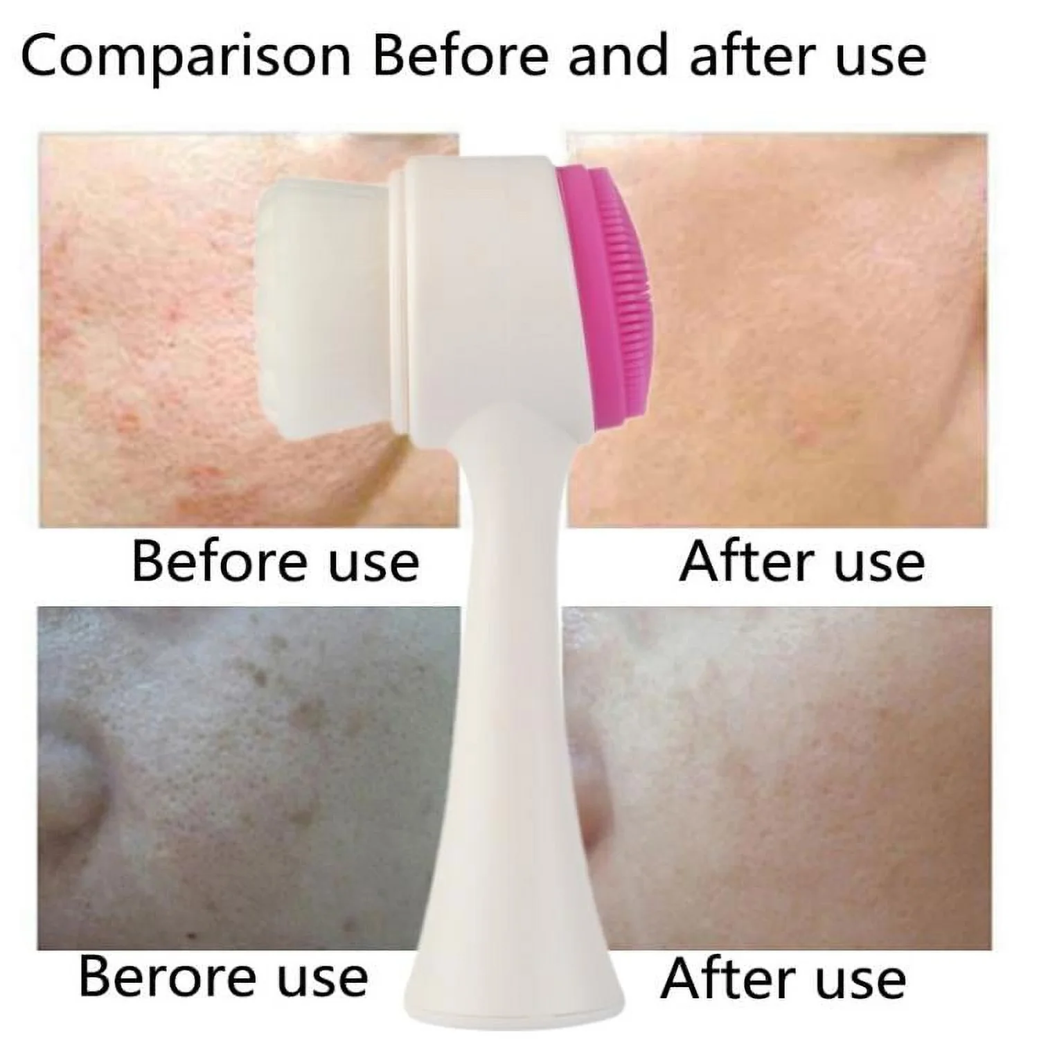 2 in 1 Facial Brush Cleansing Face Scrubber for Sensitive, Delicate, Dry Skin (1 Pc) - Image 8