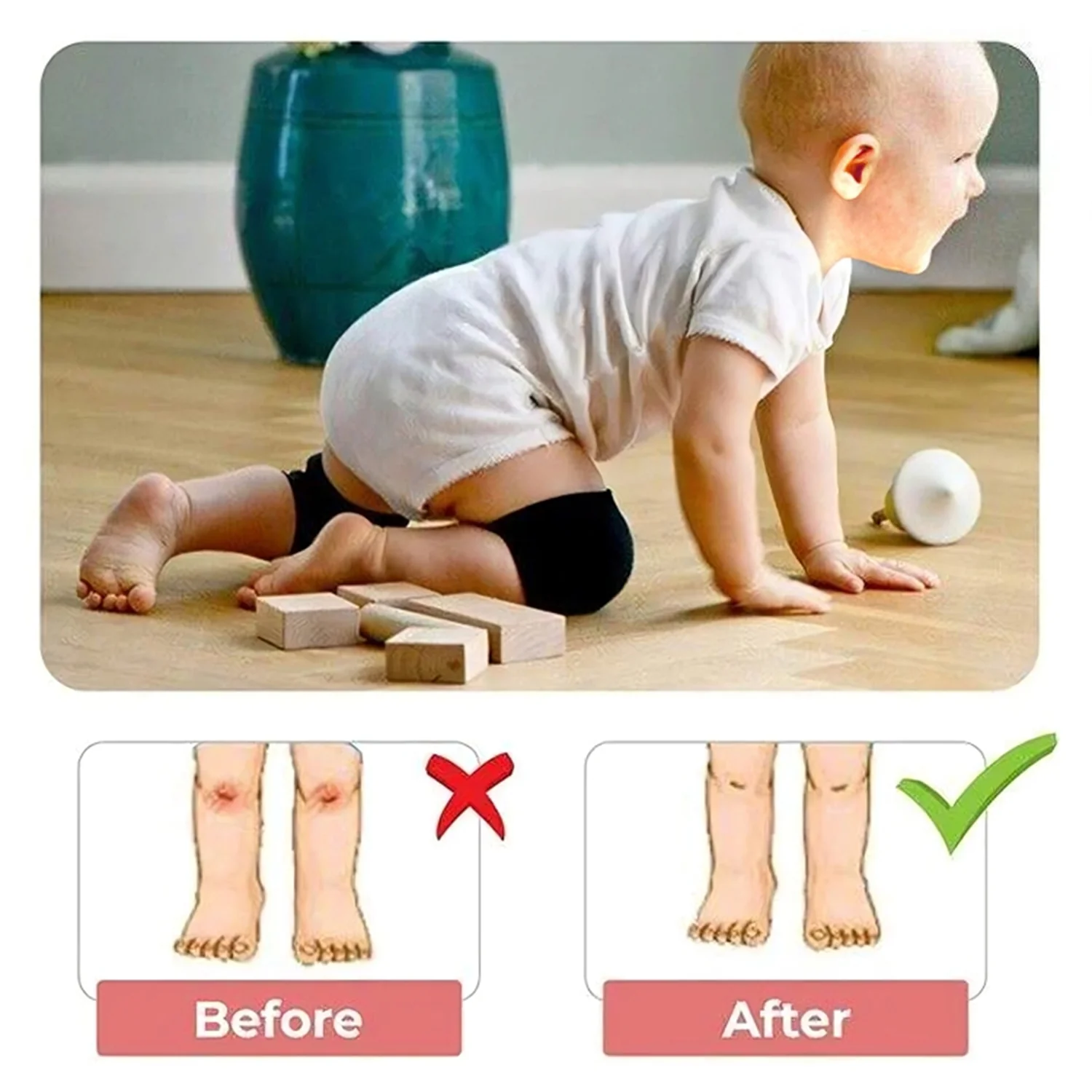 1 Pairs Baby Knee Pads for Crawling (1 Pair / 6 Cm) - Image 4
