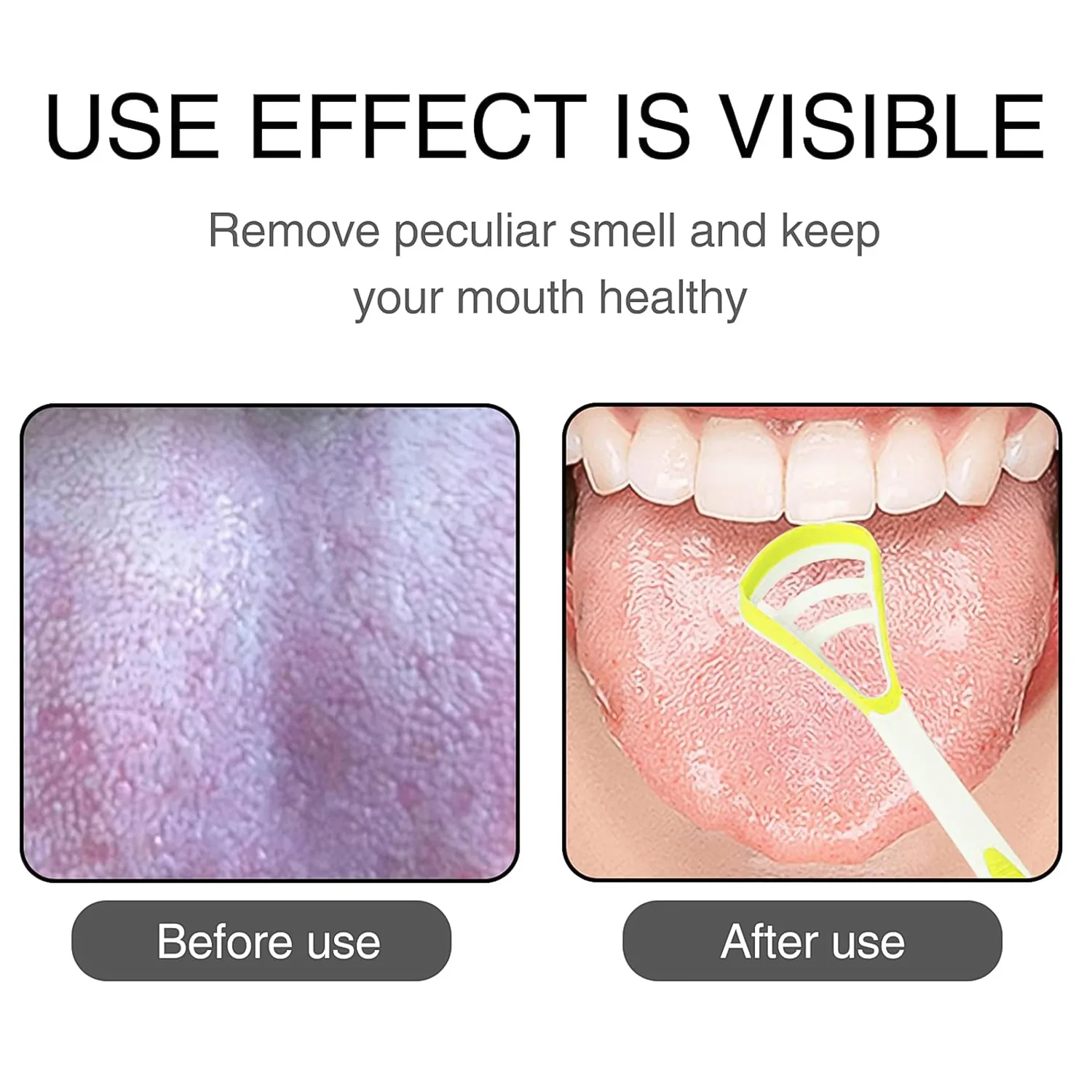 Oral Tongue Cleaner – Stainless Steel Scraper for Personal Dental Care - Image 3