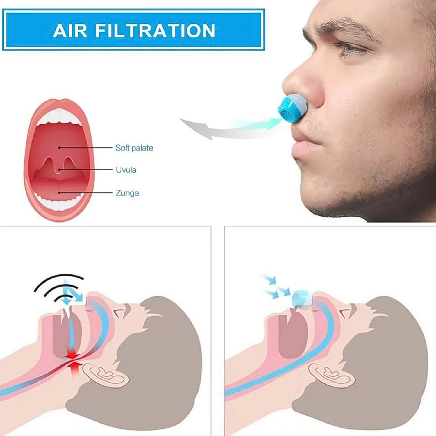 2 in 1 Anti-Snoring & Air Purifier Nose Clip Device (1 Pc / With Plastic Case) - Image 3