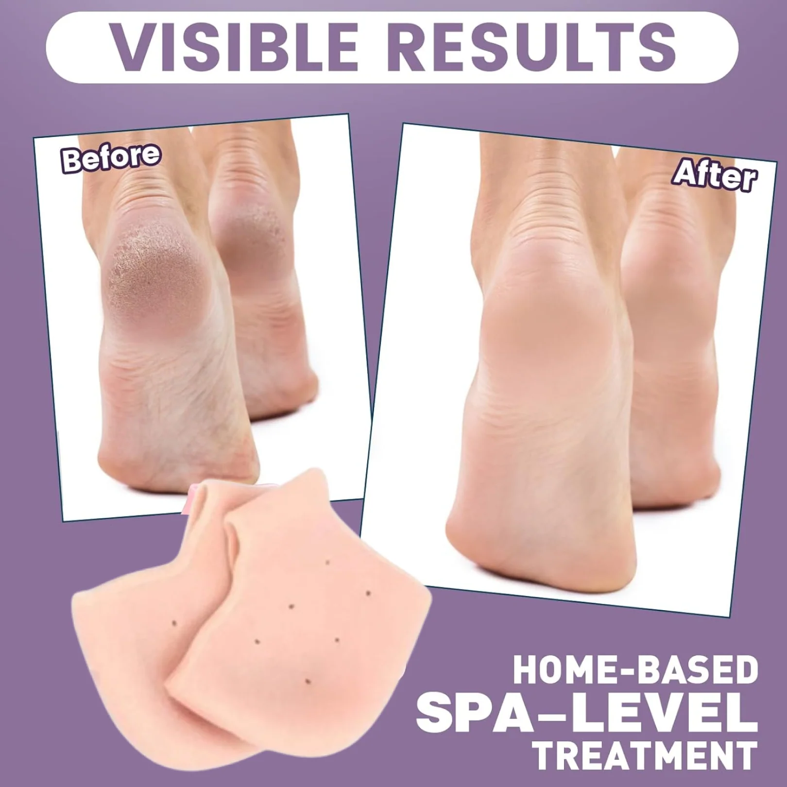 Anti Crack Silicone Half Gel Heel And Foot Protector Moisturizing Socks - Image 3