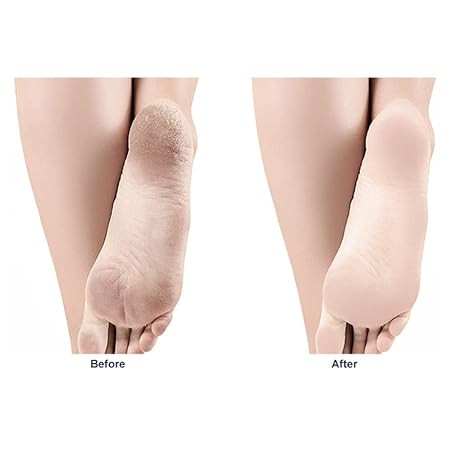 Nano Glass Foot Scraper – Dead Skin Exfoliating Foot Grinding Tool - Image 4
