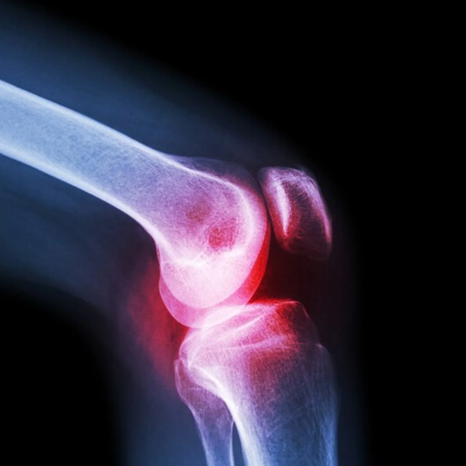 Knee Cap for Knee Support (Large) - Image 6