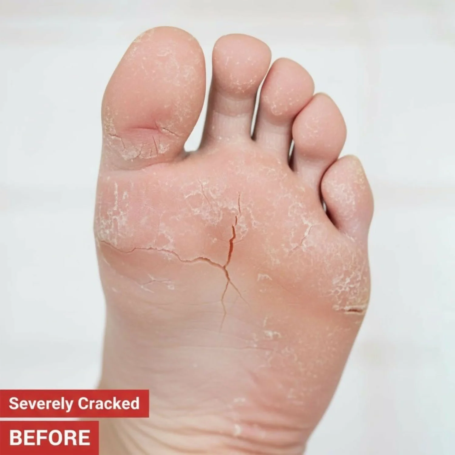 Eyelet Foot Cream for Cracked Heels & Dry Feet Deep Moisturizing Care (50Ml) - Image 5