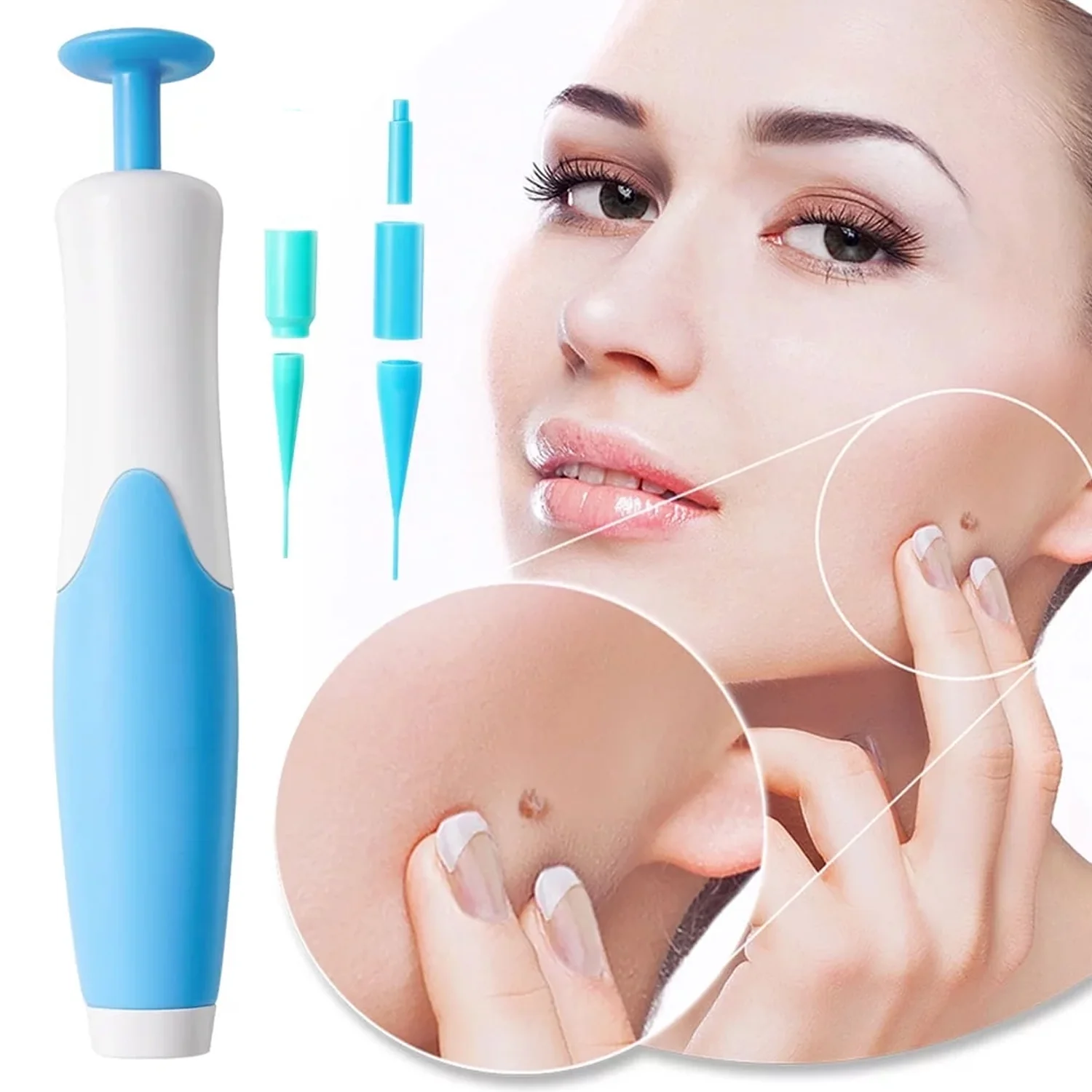 Skin Tag Remover Kit 2 in 1 for Micro to Large (2 mm - 8 mm / 1 Set) - Image 3