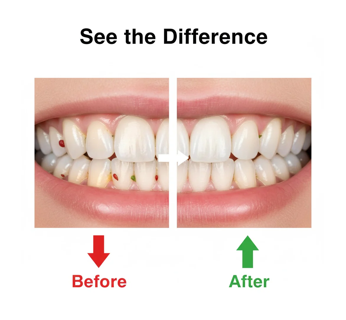 Smart Water Flosser Teeth Cleaner For Cleaning Teeth - Image 4