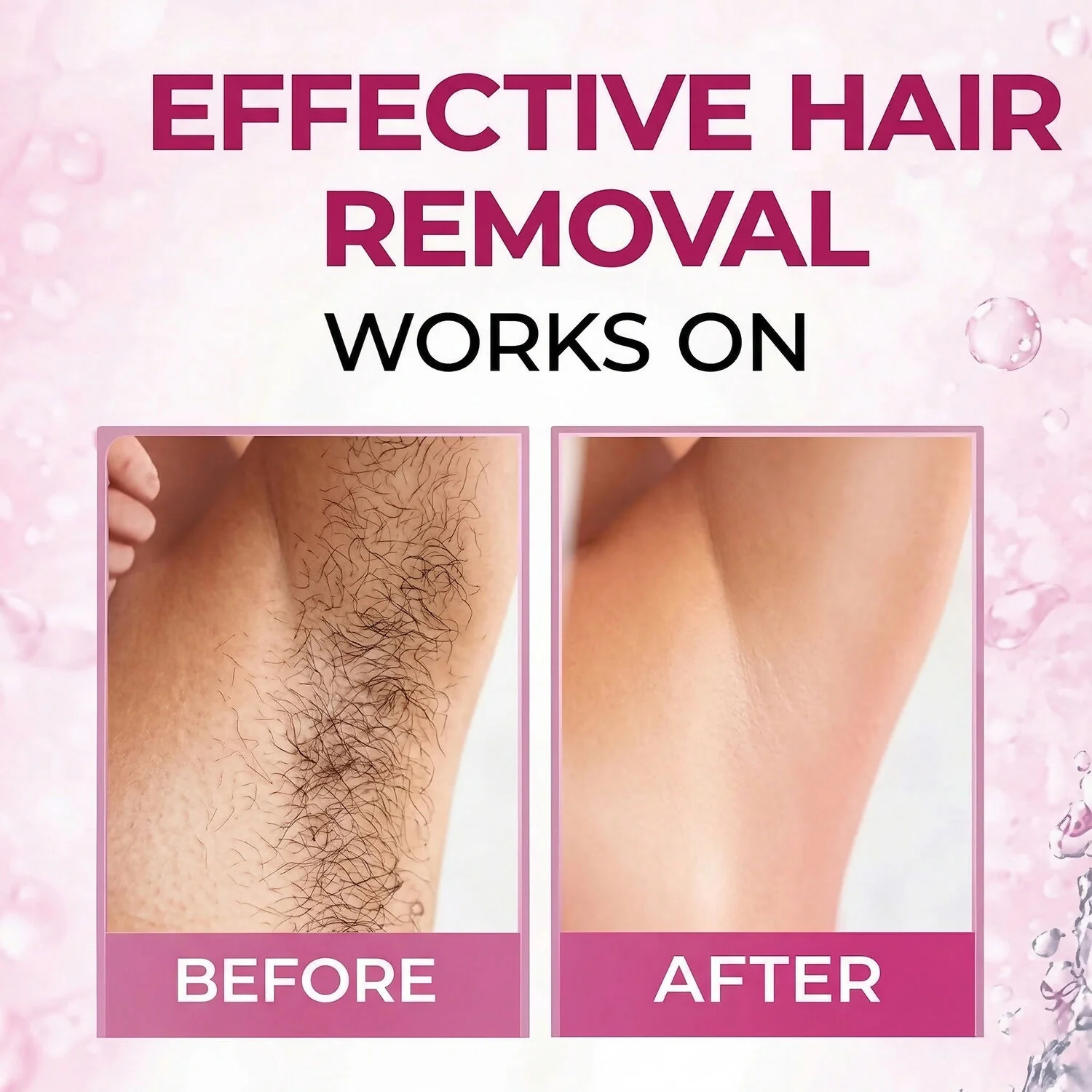 Women Hair Removal Spray Smooth Skin Fast Action Aloe Vera Formula (50 Ml) - Image 3